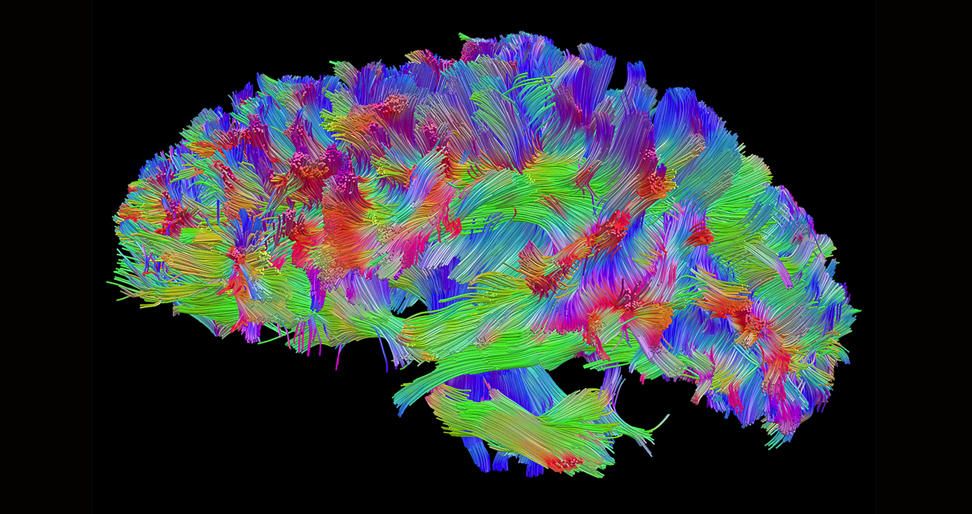 A multicolored rendering of a brain