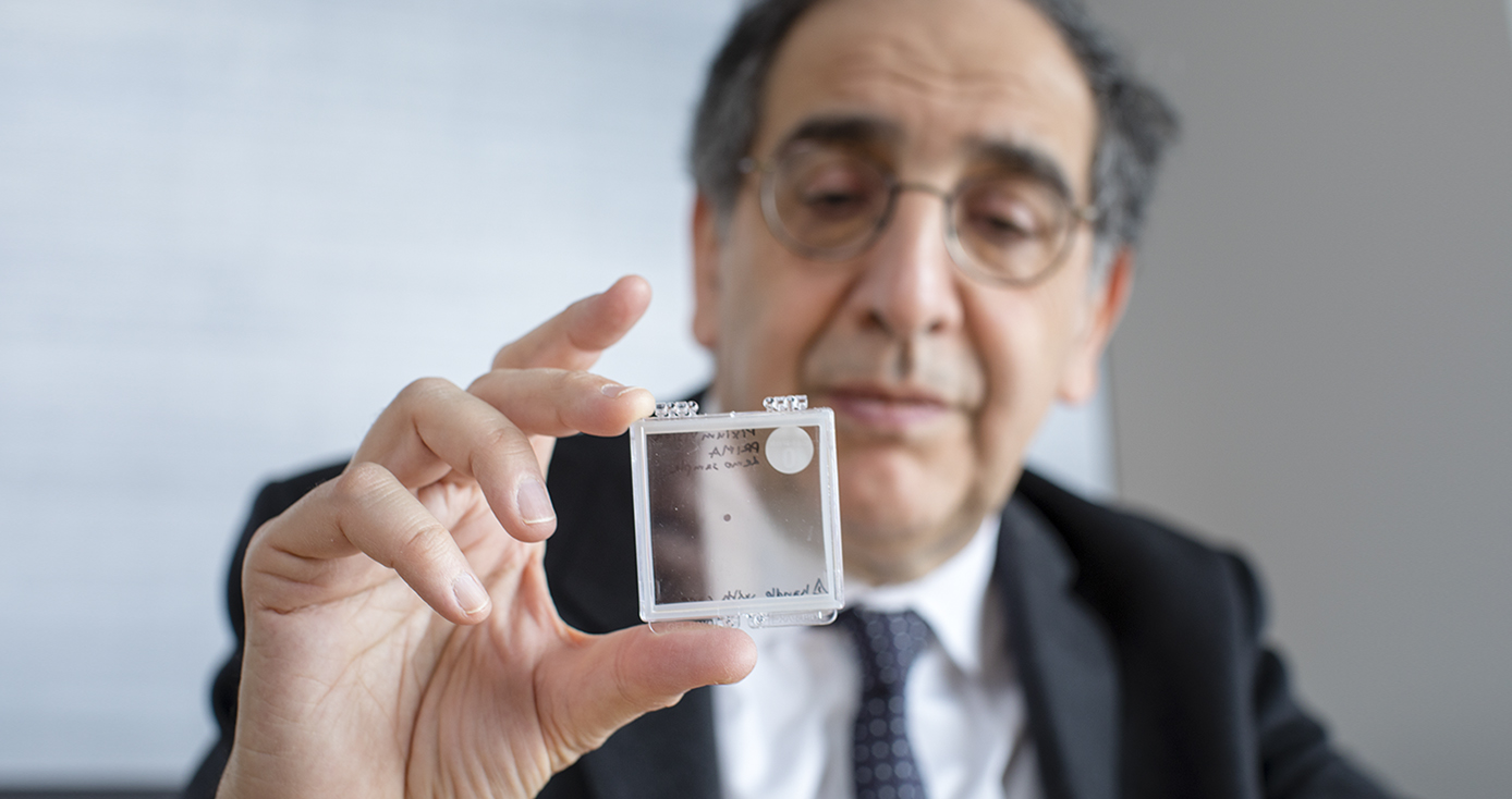 José-Alain Sahel holding the PRIMA implant, which is designed to restore sight in patients blinded by retinal degeneration.