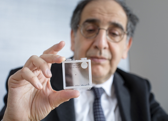 José-Alain Sahel holding the PRIMA implant, which is designed to restore sight in patients blinded by retinal degeneration.