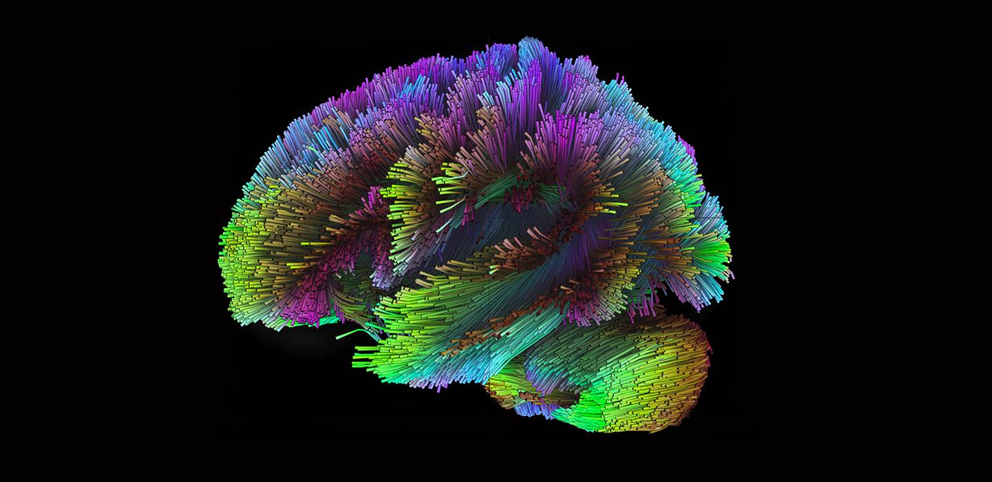 Colorful rendering of human brain