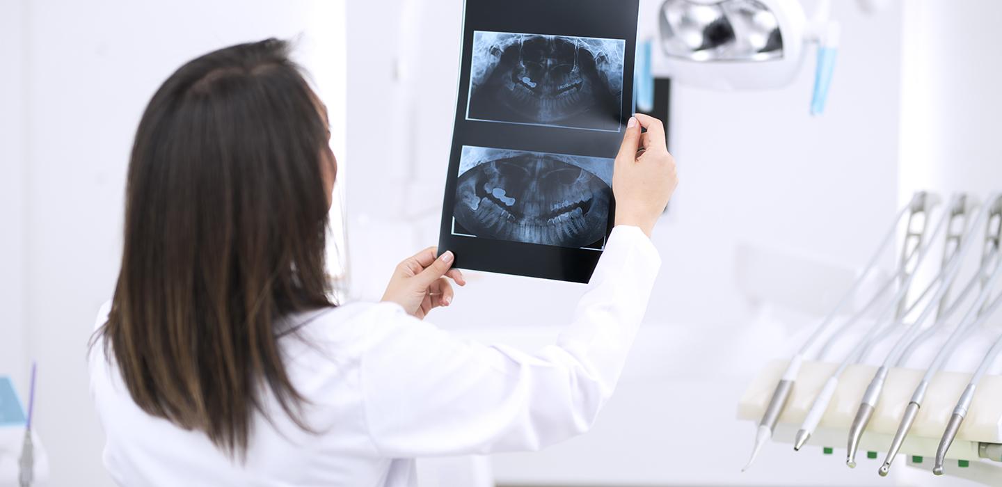 A doctor holds up an x-ray