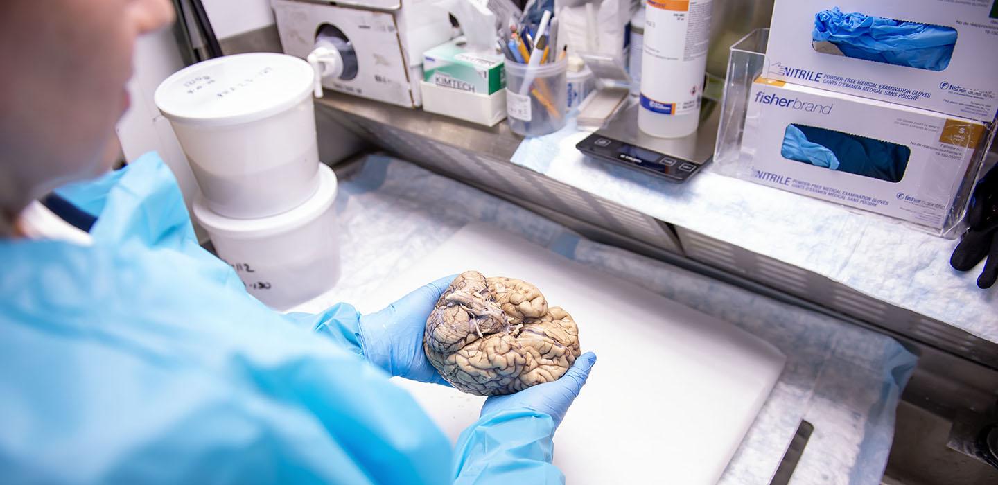 A person in blue protective wear holds a brain