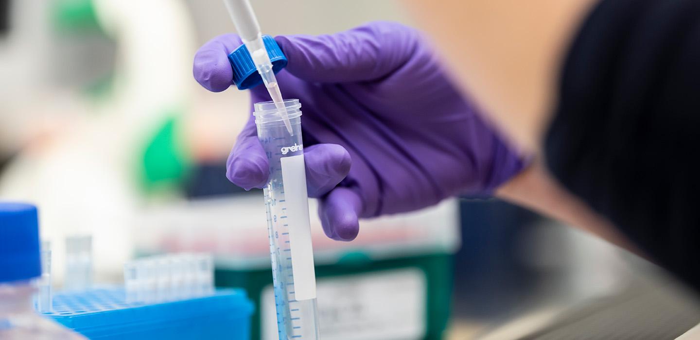 A gloved hand uses a pipette to add liquid to a test tube