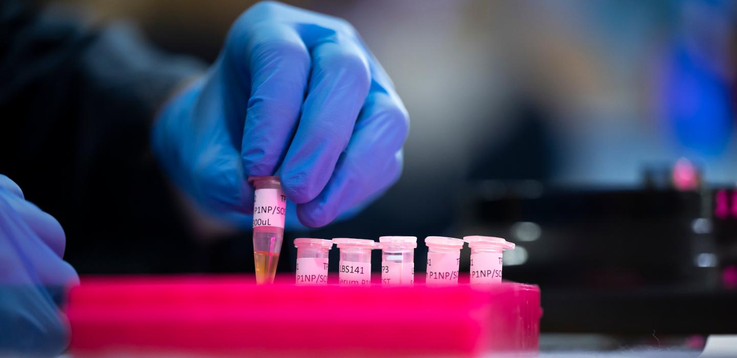 Gloved hand handling test tubes