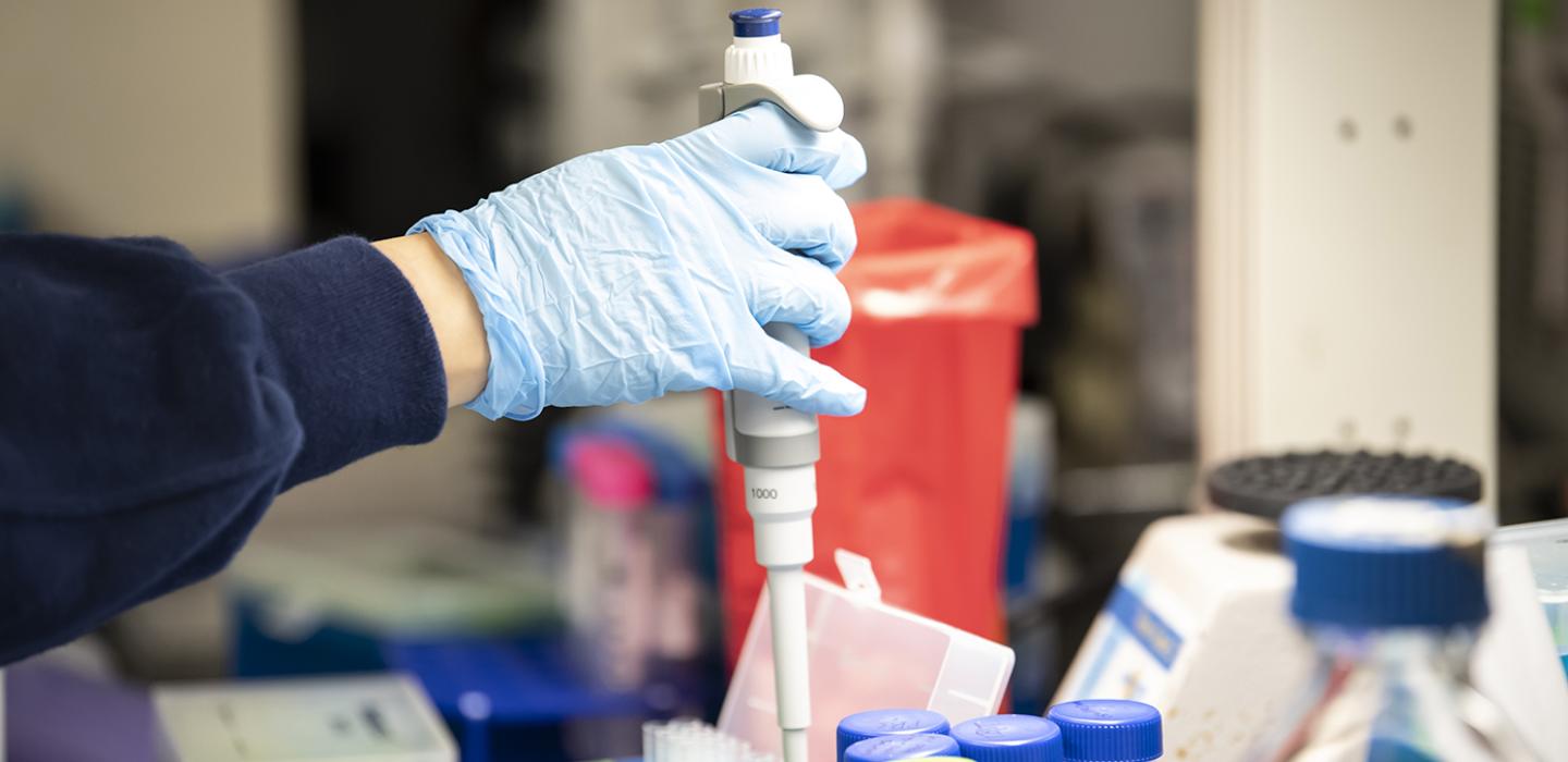 Gloved hand holding a pipette