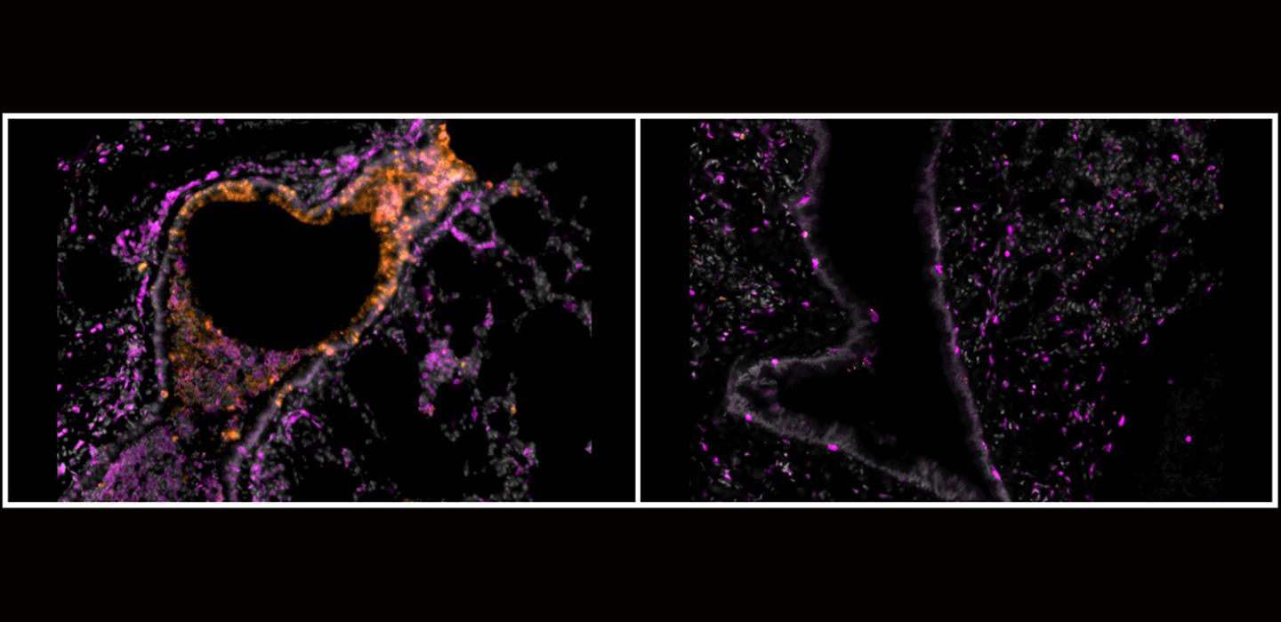 Florescent image of bronchioles
