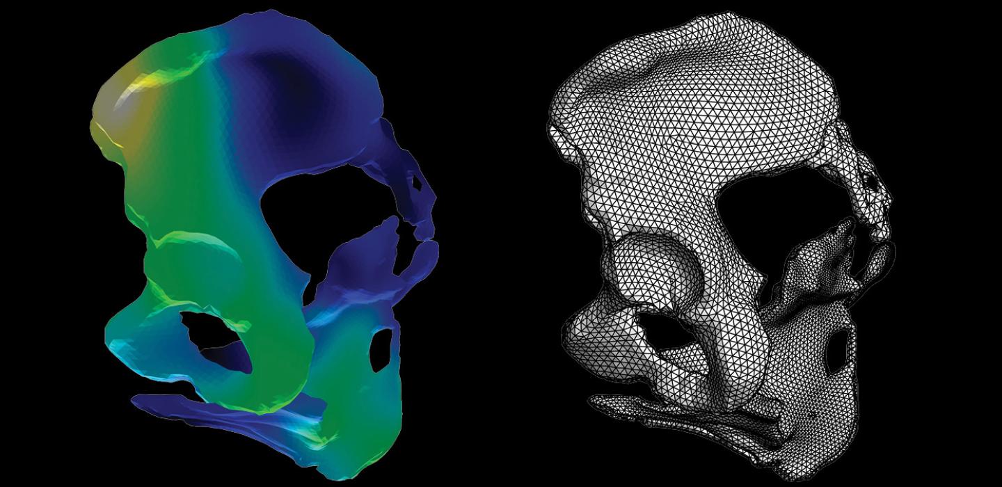MRI scans show patterns of anatomical differences of pelvises. In the colored panels, blue and black represent an average shape, and brighter colors indicate areas of high variability. Dots in the non-color scans show the individual points on which the model bases the comparisons.