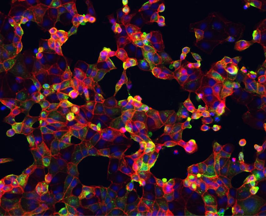 clumps of red, yellow and green on a black background