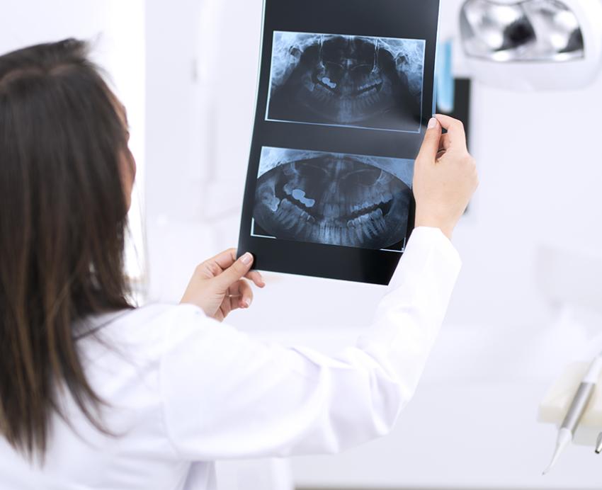 A doctor holds up an x-ray