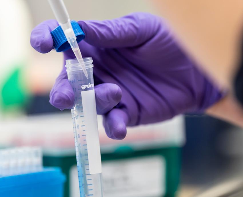 A gloved hand uses a pipette to add liquid to a test tube