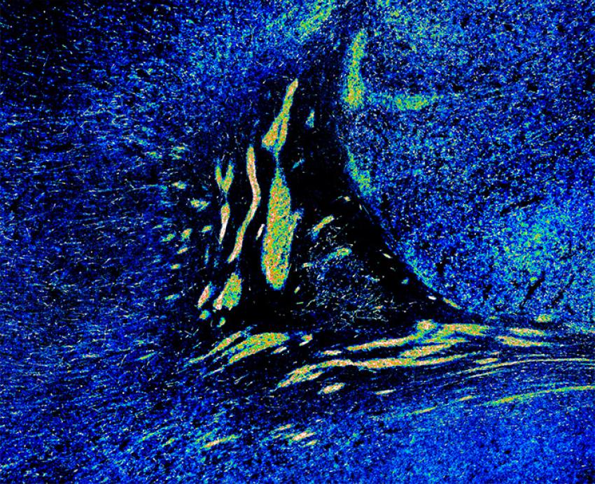A heat map shows groups of migrating cells in the brain