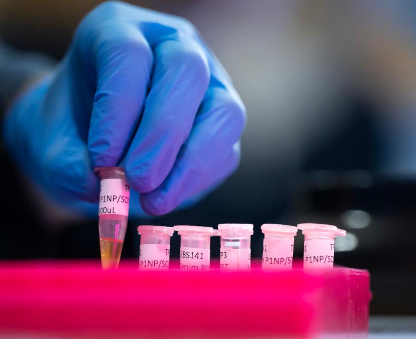 Gloved hand handling test tubes