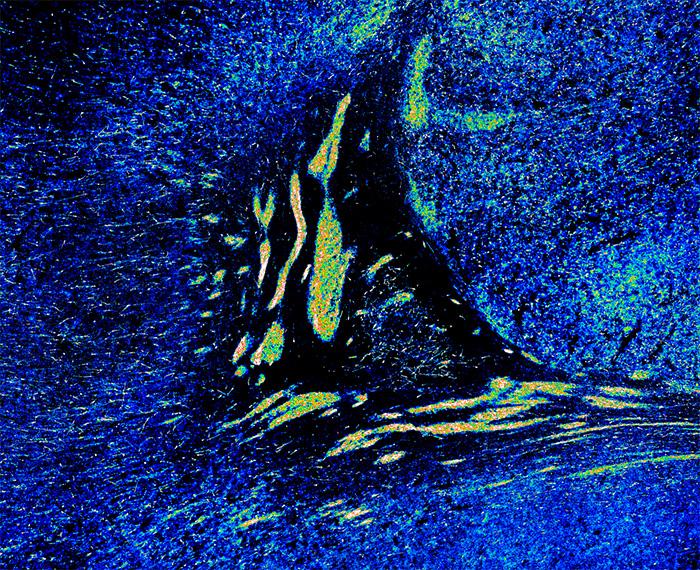 A heat map shows groups of migrating cells in the brain