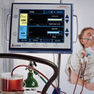 a man in a hospital bed and a monitor next to it with CO2 and blood flow numbers on it